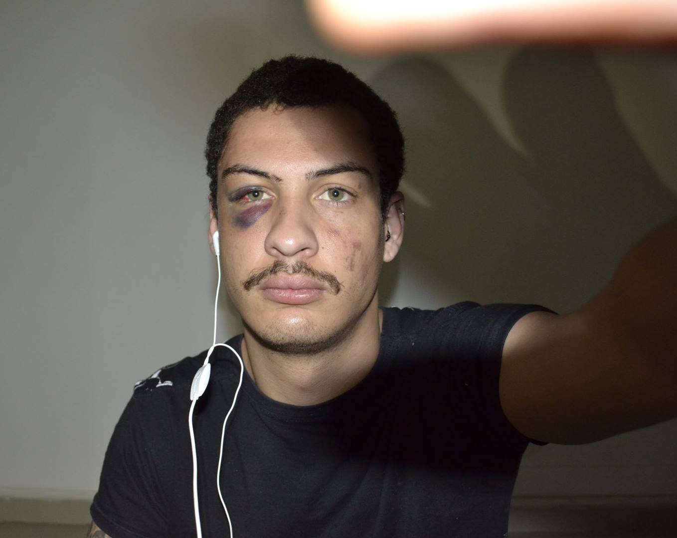 Universitário Lucas Acacio de Souza, 23, foi agredido em praia de Santos, SP (Foto: Arquivo Pessoal)
